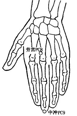 Laogong(PC8, the Spring acupoint) Laogong(PC8, the Spring acupoint)