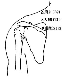 Tianliao(TE15) Tianliao(TE15)