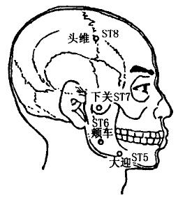 Jiache(ST6) Jiache(ST6)