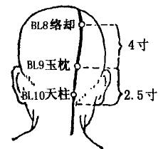 Yuzhen(BL9) Yuzhen(BL9)