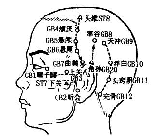 Tinghui(GB2) Tinghui(GB2)