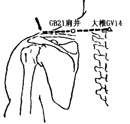 Jianjing(GB21) Jianjing(GB21)