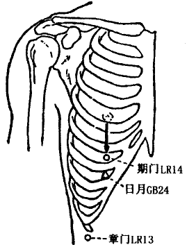 Qimen(LR14) Qimen(LR14)