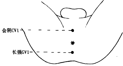 Huiyin(CV1) Huiyin(CV1)