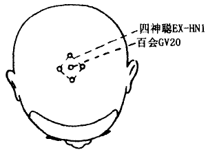 Sishencong(EX-HN1) Sishencong(EX-HN1)