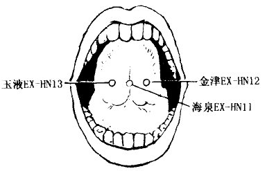 Haiquan(EX-HN11) Haiquan(EX-HN11)