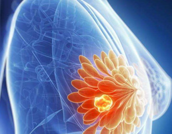 Chinese Healing Herbs for Breast Cancer Chinese Healing Herbs for Breast Cancer